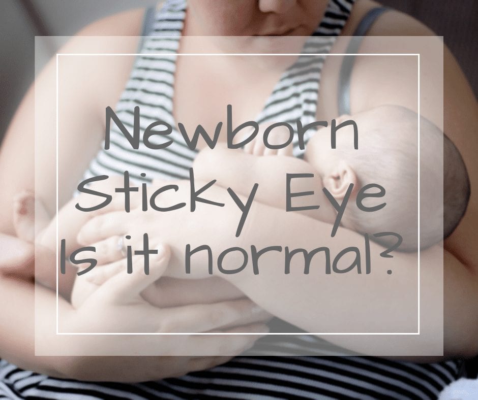 Newborn sticky eye